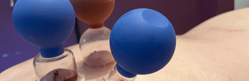 Blood cupping