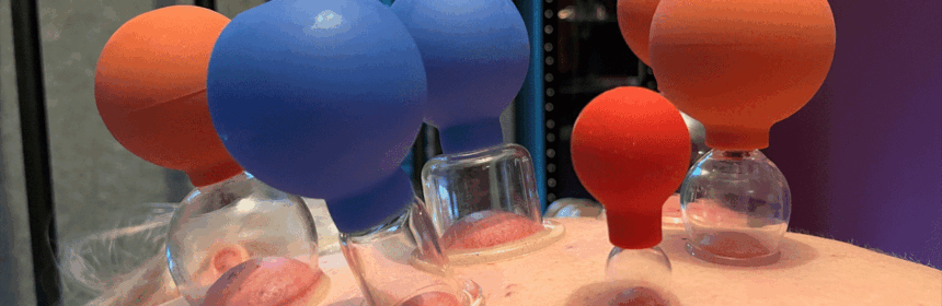 Cupping