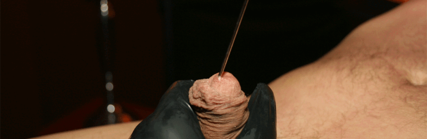 Dilator play