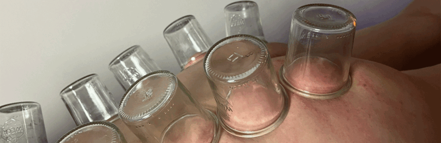 Firecupping