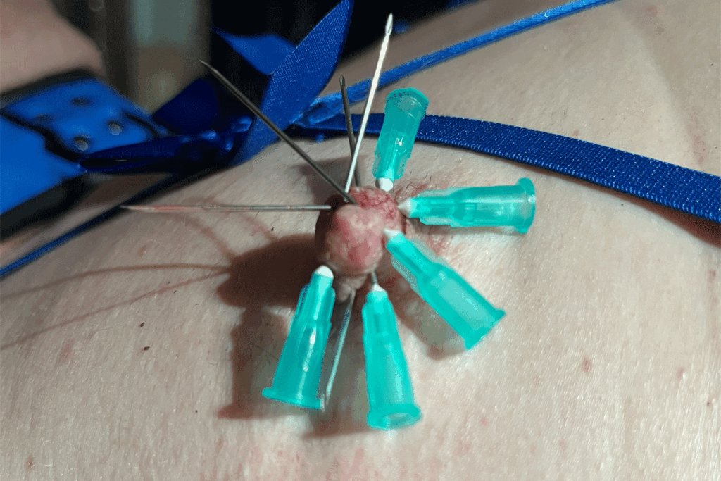 Injectienaalden