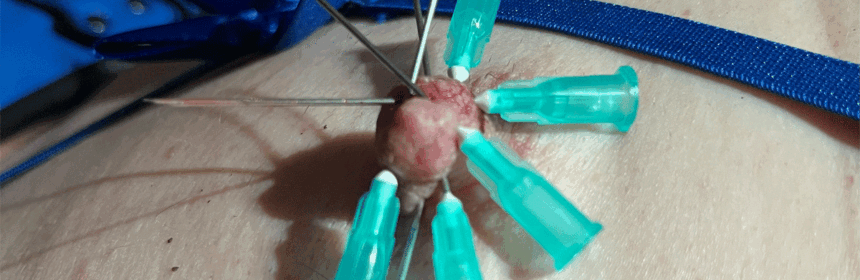 Injectienaalden - Injection needles