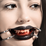 Mondspreider - Mouth spreader