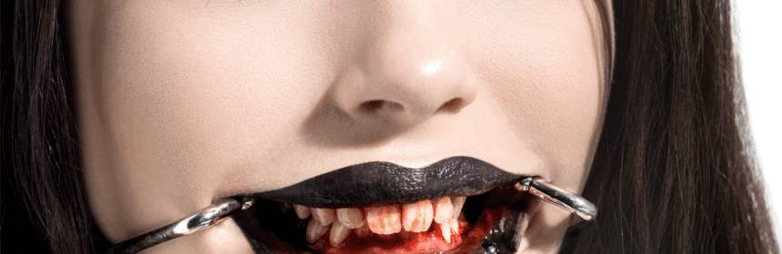 Mondspreider - Mouth spreader