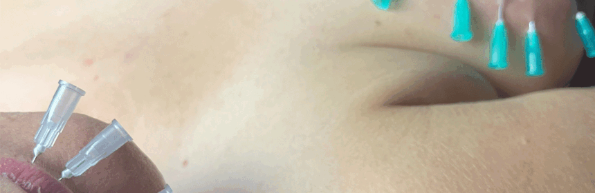 Pijngrens - Pain threshold